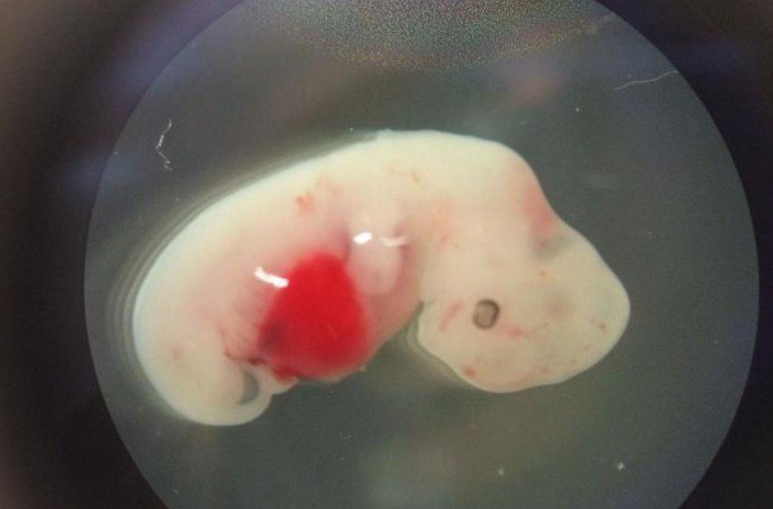Επιστήμονες στις ΗΠΑ δημιούργησαν το πρώτο υβρίδιο ανθρώπου με γουρούνι!